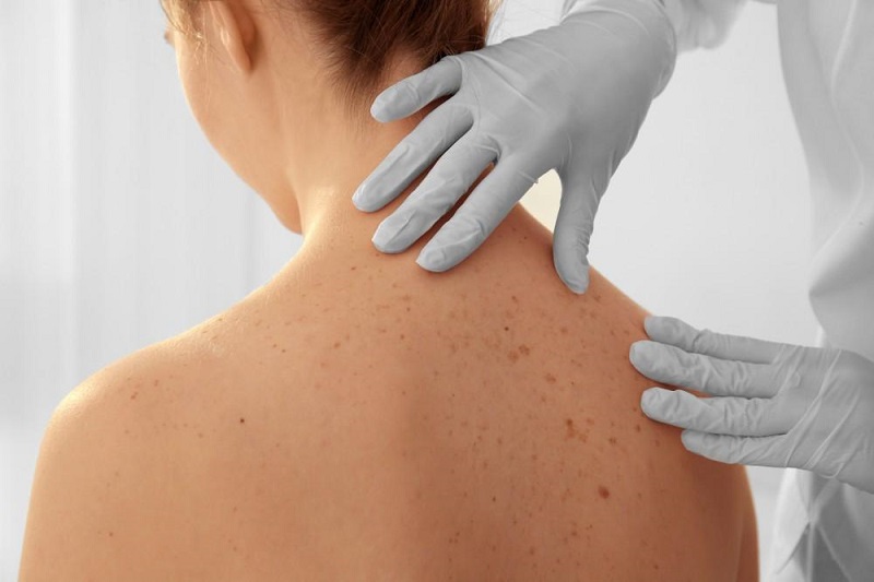 Skin Cancer: ਕਿਹੜੇ ਲੋਕਾਂ ਨੂੰ ਹੁੰਦਾ ਹੈ ਸਕਿਨ ਕੈਂਸਰ, ਜਾਣੋ ਕੀ ਹੈ ਕਾਰਨ